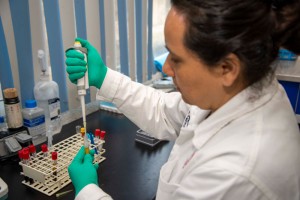 UAEM invita a su comunidad a la donación altruista de sangre